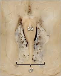 <p>Cribriform plate</p>