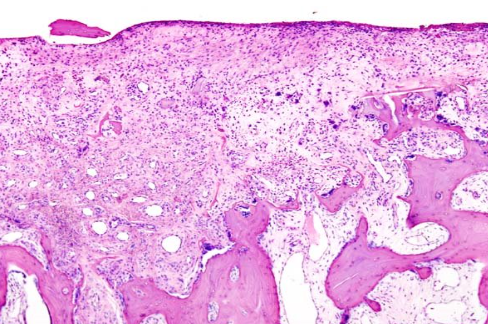 <p>What is the pathology?</p>