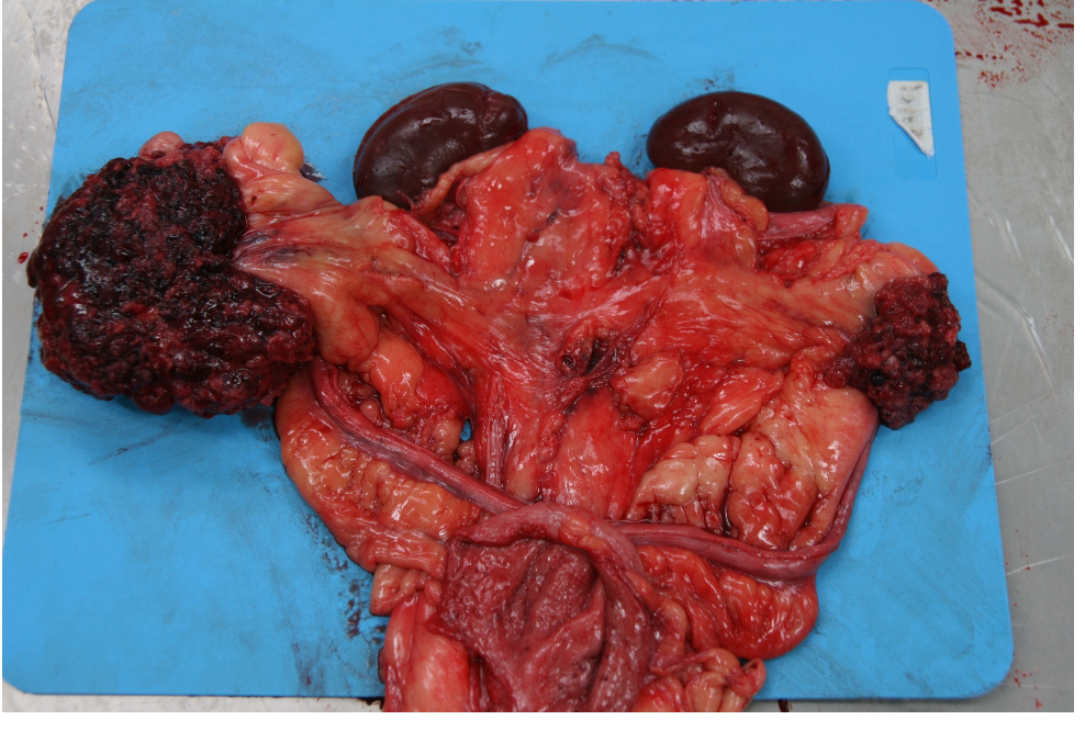 <p><strong>Du obducerar en hund och hittar maligna förändringar i ovarierna (se bild) samt ascites.</strong></p><p class="p1"><strong>Ange den mest troliga diagnosen. (1p)</strong></p>