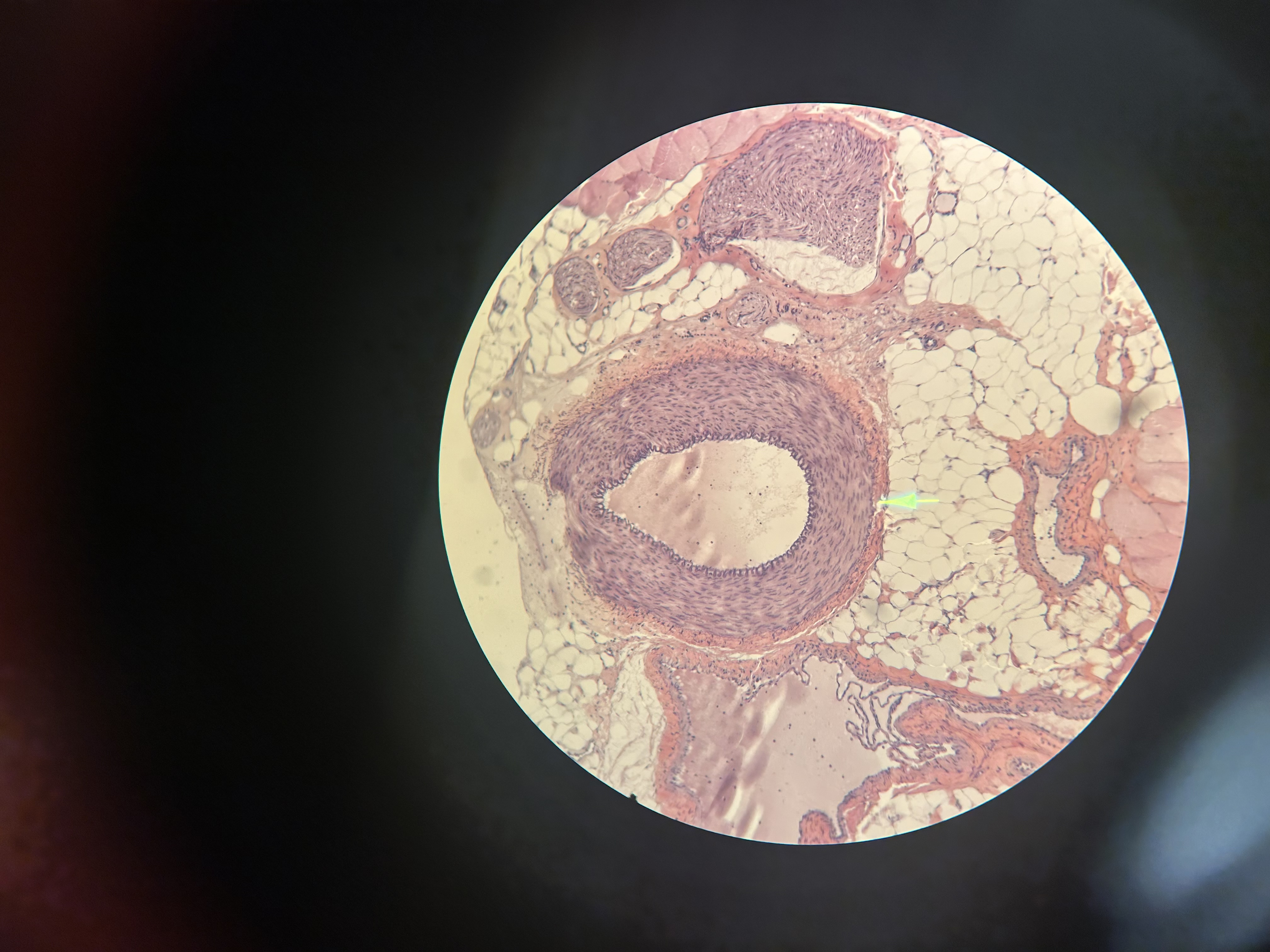 <p>Name the image shown. What feature is the arrow pointing to? (on the back)</p>