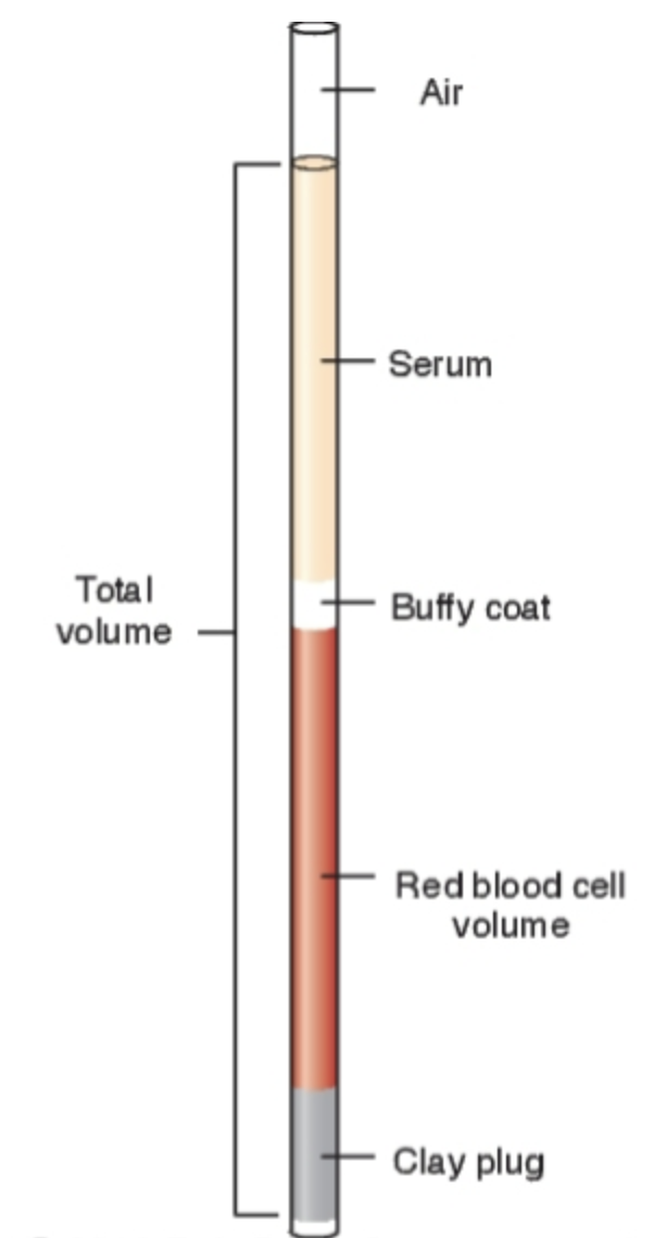 <ul><li><p><span style="background-color: transparent;">Percentage of red cells in a given volume of whole blood.</span></p></li><li><p><span style="background-color: transparent;">Manual spun HCT centrifuges blood into layers</span></p></li><li><p><span style="background-color: transparent;">Volume of packed red cells reported to nearest 0.5%</span></p></li></ul><p><span style="background-color: transparent;"><u>Sources of Error</u></span></p><ul><li><p><span style="background-color: transparent;">Pre-analytic/blood collection errors</span></p></li><li><p><span style="background-color: transparent;">Not wiping off first blood drop if collected by fingerstick</span></p></li><li><p><span style="background-color: transparent;">EDTA tube must be at least half full for manual HCTs</span></p></li></ul><p><span style="background-color: transparent;"><u>Analytic/technical errors</u></span></p><ul><li><p><span style="background-color: transparent;">Improper use of HCT card reader</span></p></li><li><p><span style="background-color: transparent; font-family: "Times New Roman", serif;"> </span><span style="background-color: transparent;">Control sample “out”</span></p></li><li><p><span style="background-color: transparent;">Centrifuging at improper speed or time</span></p></li><li><p><span style="background-color: transparent;">RBC count, Hgb and HCT measurements parallel each</span></p></li></ul><p></p>