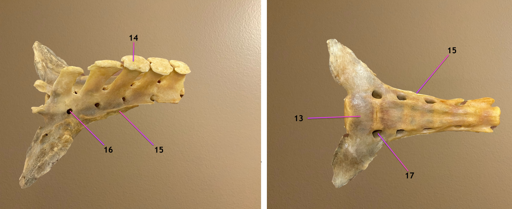 <p>left pic: dorsal view </p><p>rt pic: ventral view</p><p>.</p><p>what bone is this</p><p>.</p><p>label the parts of it: 13-17</p>