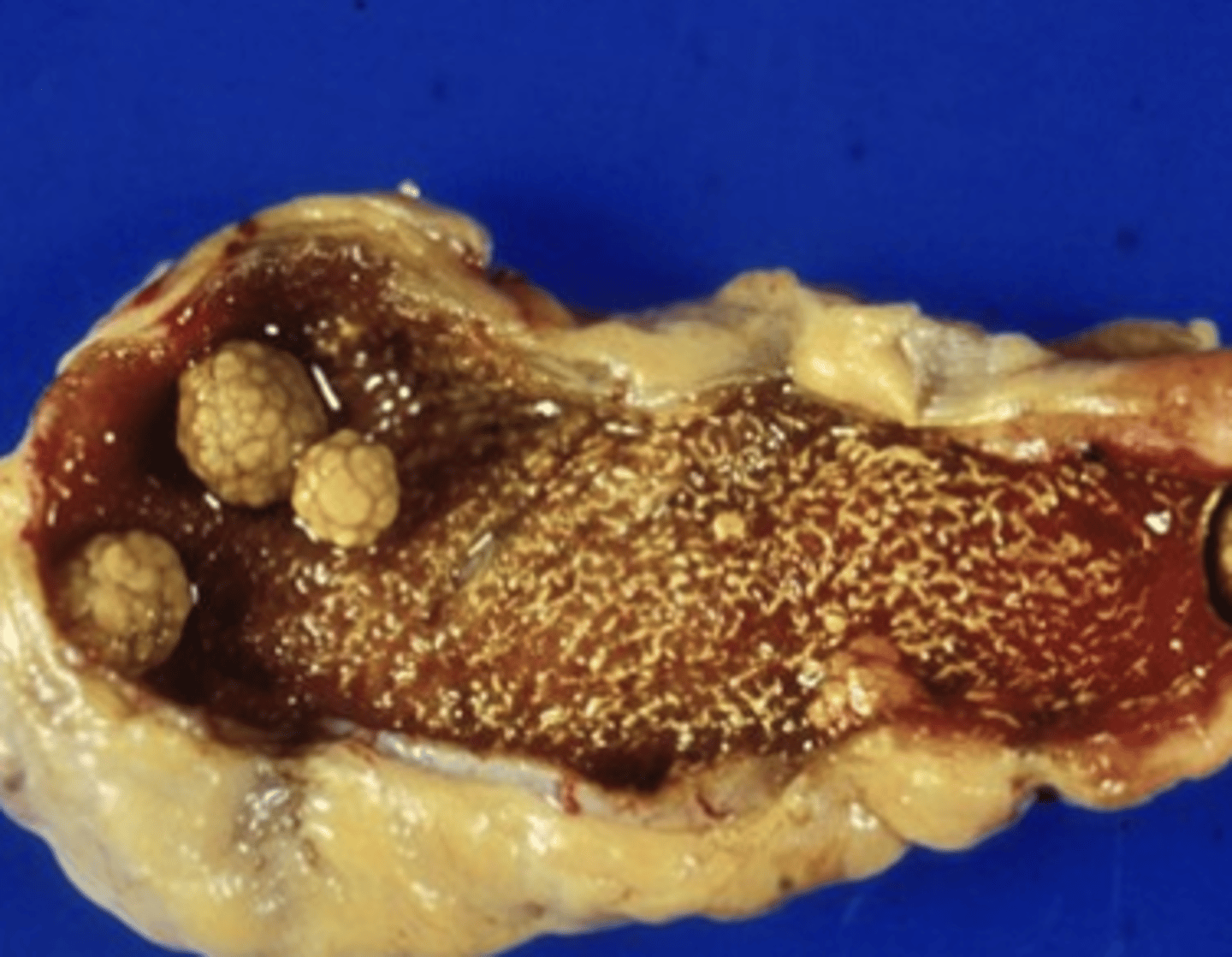 <p>knobby covered in small rounded bumps like a raspberry</p>