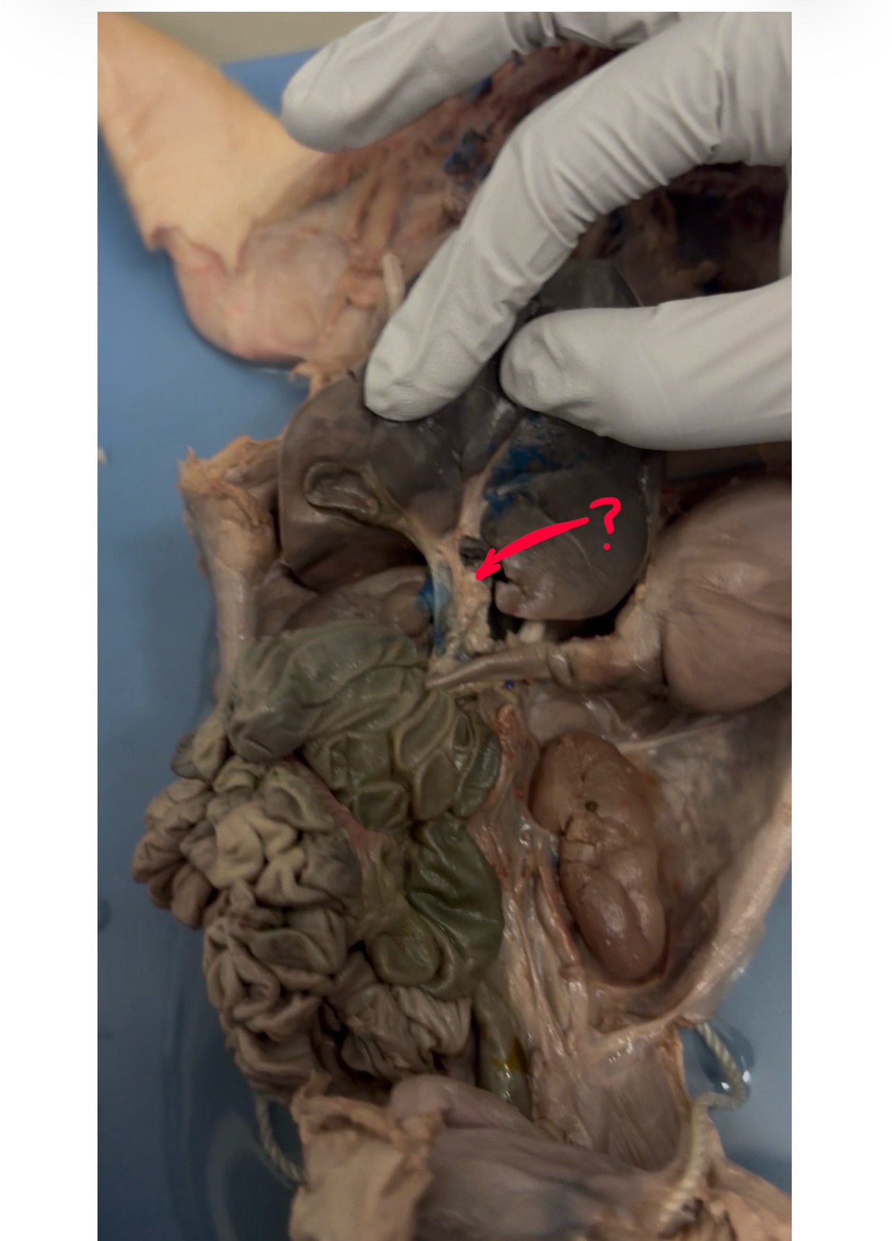 <p>What is the red line pointing to? What is the purpose?</p>