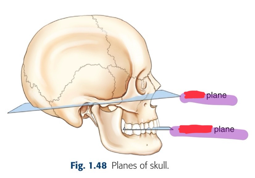<p>what is the transverse plane here that connects the lines from the infraorbital margins to the external auditory meatus (EAM)?</p>