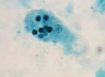 <p><span style="background-color: rgba(0, 0, 0, 0); line-height: 19.7625px;">What is the species seen in this photo and WHY?</span></p>