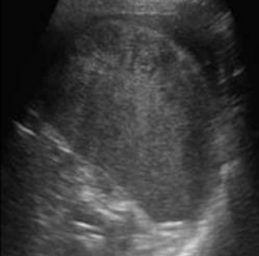 <p>Identify this image. </p>