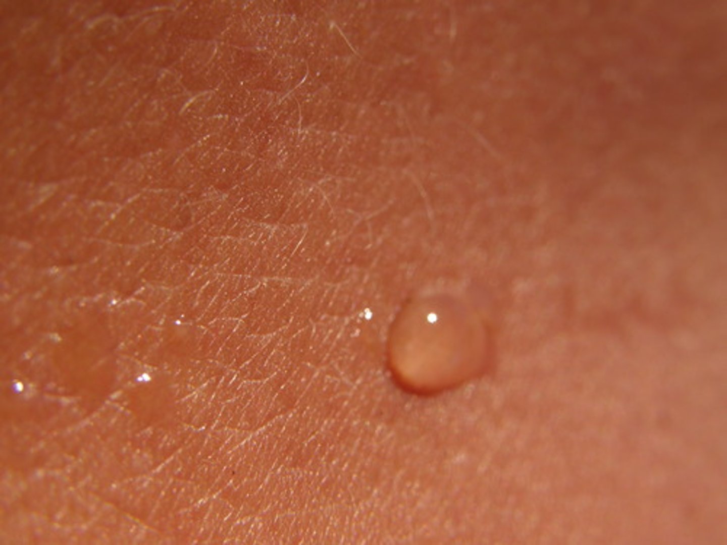 <p>it covers almost the entire body and helps keep all the organs and muscles in place.</p>