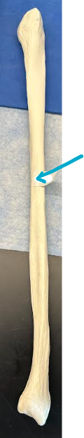 <p>ID fibula/clavicle region</p>