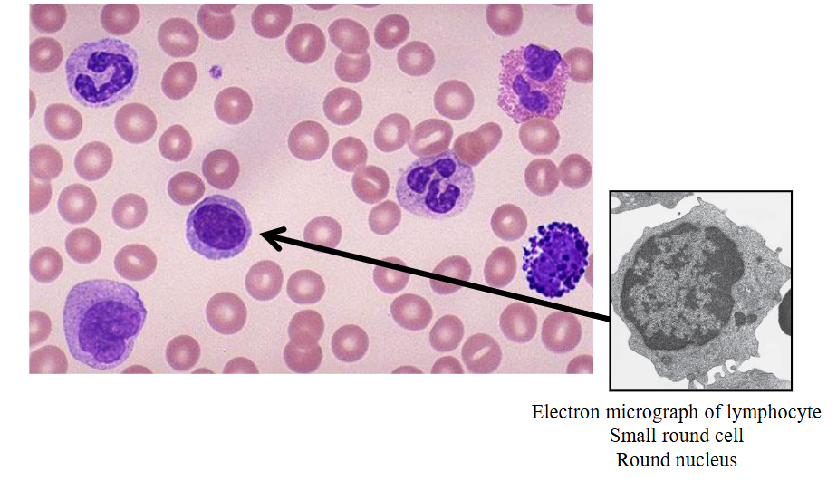 <p>- second most common white cells in blood</p><p>- small round cell produced in bone marrow</p><p>- two main subtypes depending on antigen expression: B cells and T cells</p><p>- B cells are antibody producing, T cells involved in cell mediated immunity</p><p>- also another subtype called natural killer cells (these have granules in cytoplasm which contain enzymes involved in cell killing)</p>