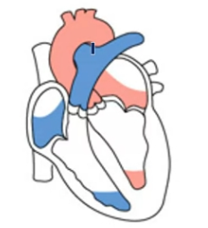 <ul><li><p>Ventricular diastole begins</p></li><li><p>Pressure falls below that in the major arteries</p></li><li><p>Semilunar valves close</p></li><li><p>For another moment, the ventricles are completely closed chambers</p></li><li><p>When atrial pressure increases above intraventricular pressure, the AV valves open</p></li></ul><p></p>