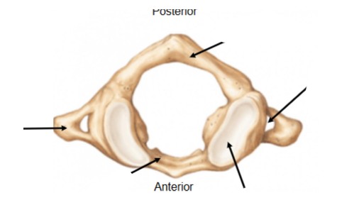 <p>What vertebrae is this</p>