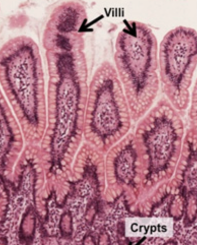 <p>Part of stomach, small intestine, and recto anal junction </p>