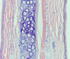 <p>What type of cartilage is this?</p>