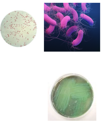 <p>How is it spread in <strong>Psuedomonas aeruginosa</strong></p>