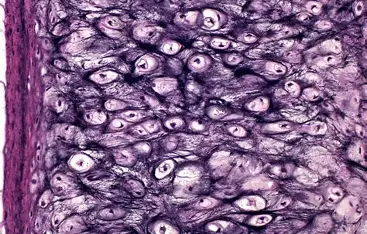 <p>Elastic Cartilage</p>