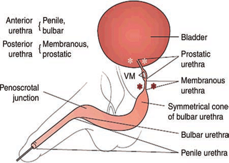 <p>What does this refer to</p><ul><li><p>Male urethra divided by the urogenital diaphragm</p><ul><li><p>Anterior </p></li><li><p>Posterior</p></li></ul></li></ul><p></p>