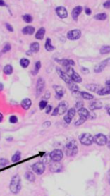 <p>What is black arrow pointing to (glomerulus)</p>