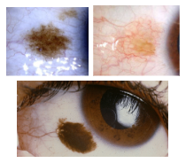 <p>What is the most likely diagnosis ?</p>