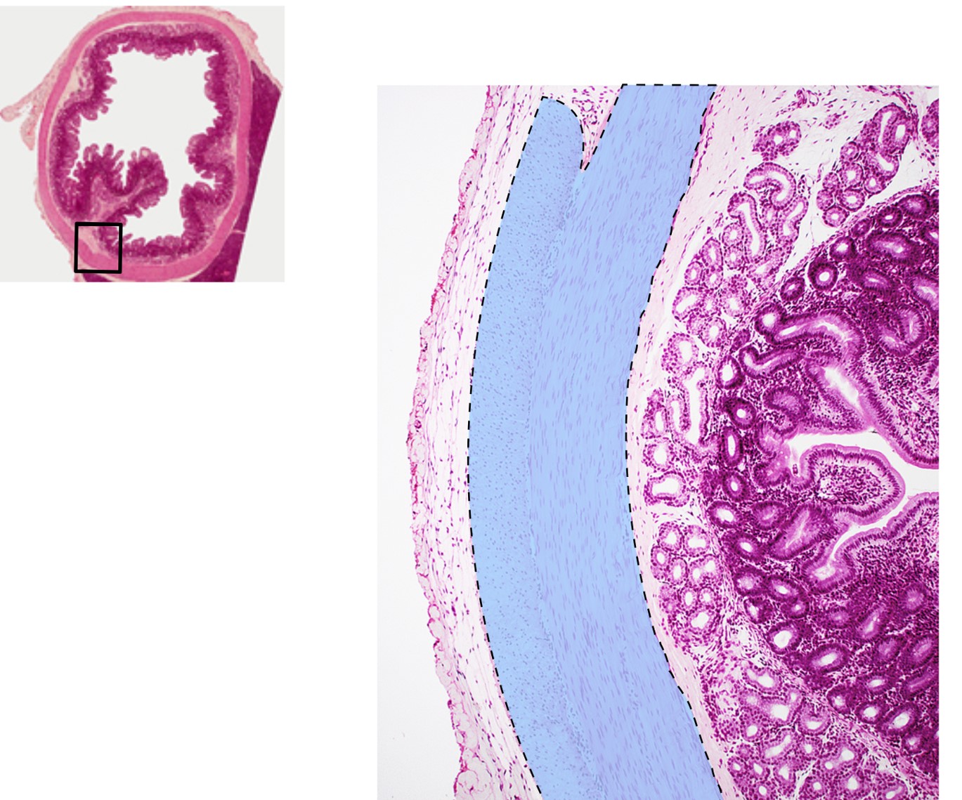 <p><span>What tissue is highlighted in this image?</span></p>