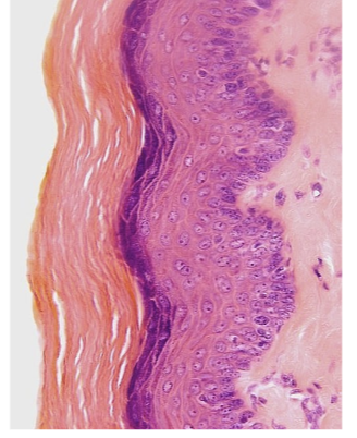 <p>&nbsp;what epithelium</p>