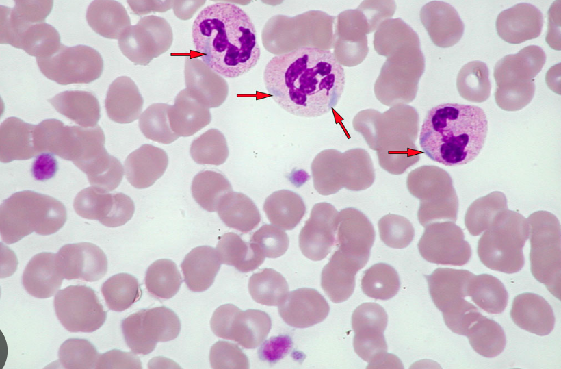 <p>Blue include bodies visible in neutrophils</p>