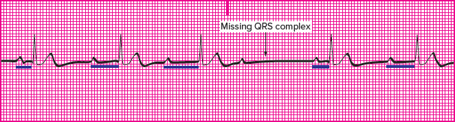 <p>Which rhythm is this?</p>