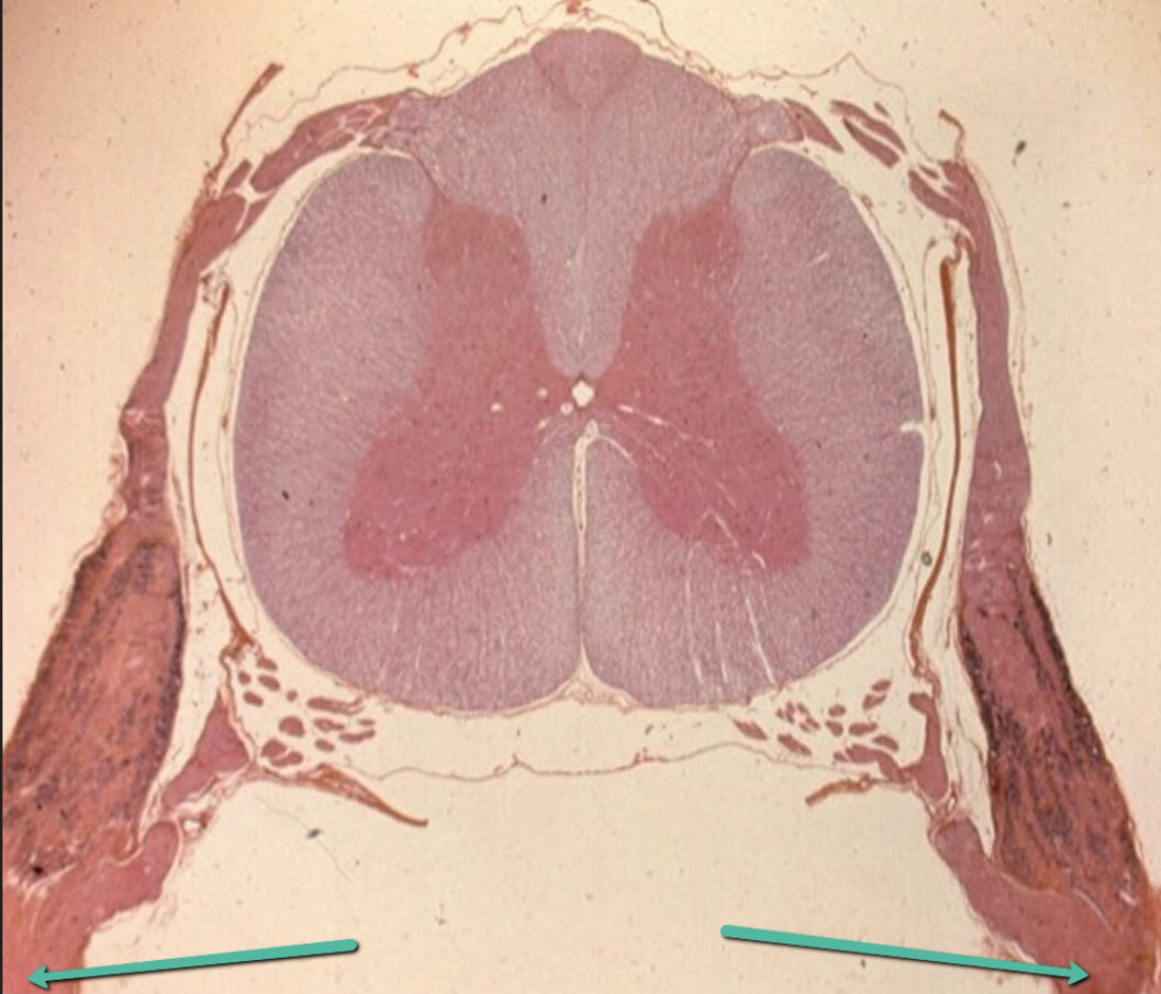 <p><span>Identify the thick dark bands indicated by the pointers.</span></p>