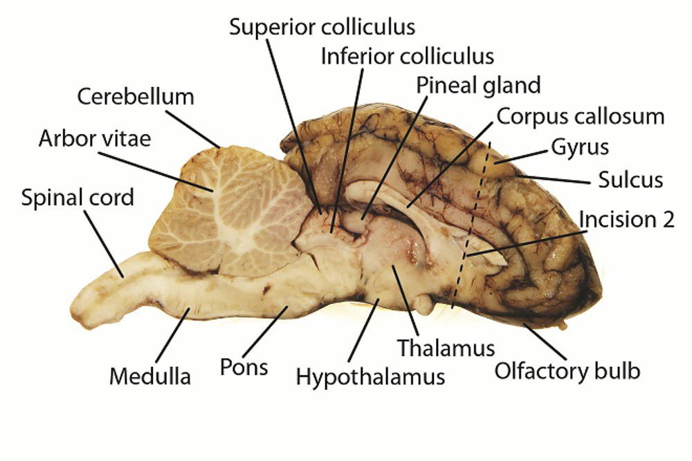 <p>- longitudinal fissure</p><p>- transverse fissure</p><p>- central sulcus</p><p>- precentral gyrus</p><p>- postcentral gyrus</p><p>- right hemisphere</p><p>- left hemisphere</p><p>- cerebellum</p><p>- vermis</p><p>- arbor vitae</p><p>- brainstem</p><p>- midbrain</p><p>- pons</p><p>- medulla (oblongata)</p>