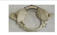 <p>what is marked? (not the star)</p>
