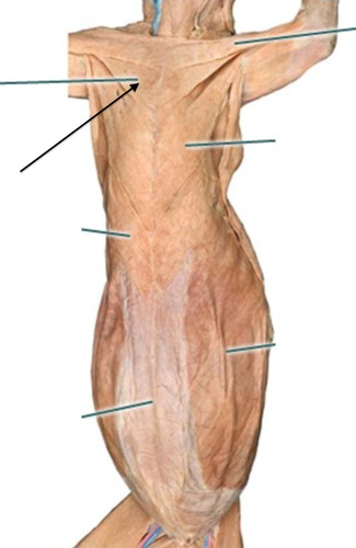 <p>Pectoralis major</p>