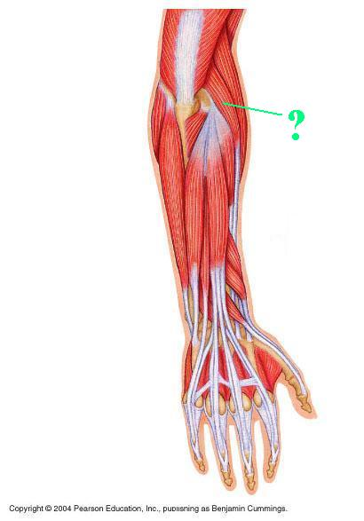 <p>Identify the indicated muscle</p>