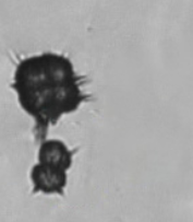 <p>Yellow/brown, throny apples</p><p>Normal, Seen in alkaline urine</p>