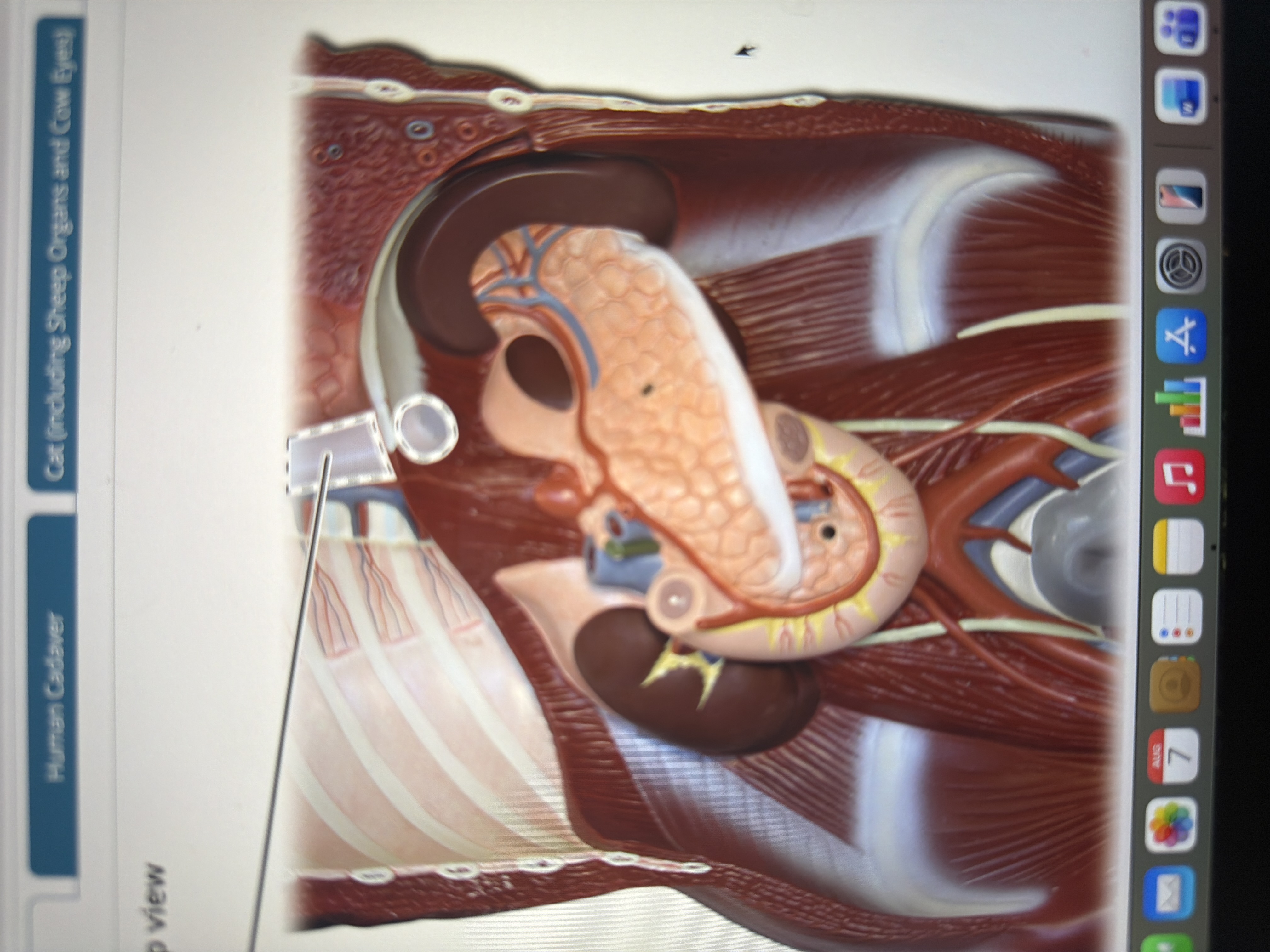 term image