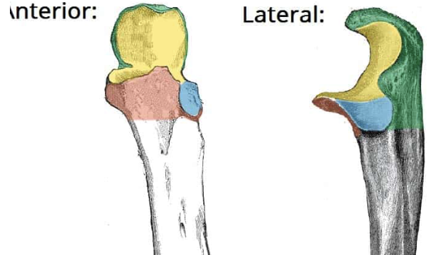 <p>What is the yellow area?</p>