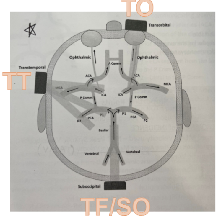<p>Which of the following is not a window used during a TCD exam?</p><ul><li><p>Options: Transtemporal, Subocciptal (Transforaminal), Transorbital, Subcaudal</p></li></ul><p></p>