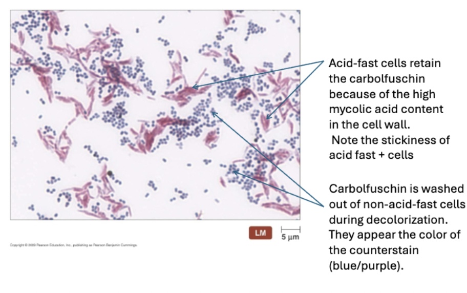 <p>Identifies Mycobacterium species; acid-fast bacteria retain carbol fuchsin (red), while non-acid-fast bacteria take up methylene blue.</p>