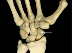 <p>In this skeleton of the right wrist, identify the bone indicated by the arrow.</p>