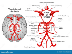 <p>Which artery is most frequently occluded by emboli?</p>