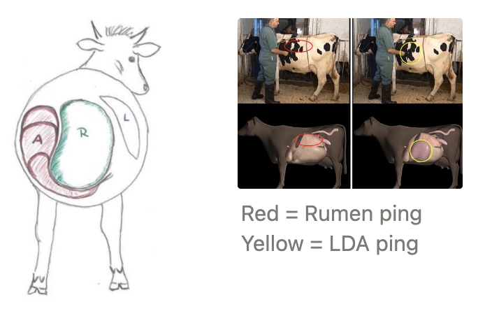 <p><u>Mechanism:</u></p><ol><li><p>Anatomy, mechanical and metabolic factors cause abomasum to shift to the LEFT of midline</p></li><li><p>Abomasum distends with gas to occupy space between left body wall and rumen</p></li><li><p>Partial obstruction of pyloric outflow</p></li></ol><p><u>Clinical Signs:</u></p><ol><li><p>Sudden drop in milk production</p></li><li><p>Anorexia</p></li><li><p>Bright(ish) and no fever</p></li><li><p>Mild constipation OR diarrhoea</p></li><li><p>Concurrent illness</p></li><li><p>Distended left paralumbar fossa (no dorsal triangle)</p></li></ol><p><u>Diagnosis:</u> History and PE →</p><ol><li><p>Metallic ping between the 9 - 12th ribs on the LEFT</p><ul><li><p>Differentiate abomasal ping from rumen ping caused by anorexia) with DOUBLE auscultation:</p><ol><li><p>Blow air into rumen via orogastric tube → Listen for bubbling sounds over the left paralumbar fossa from the rumen</p><ul><li><p>No bubbles = Abomasal ping </p></li></ul></li><li><p>Listen for rumen contraction over site of pig</p><ul><li><p>No rumen contractions = Abomasal ping (abomasum between abdominal wall and rumen)</p></li></ul></li></ol></li></ul></li><li><p>Biochemistry = Hypochloraemia, hypokalaemia, hypocalcaemia</p></li></ol><p></p>