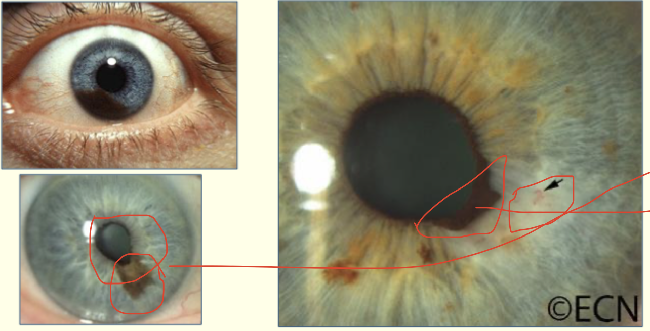 <p>Describe this image and give diagnosis</p>