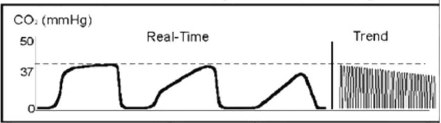 <p>Meaning of this wave</p>