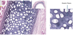 <p>name the tissue on the left</p><p>name the structure on the right</p>