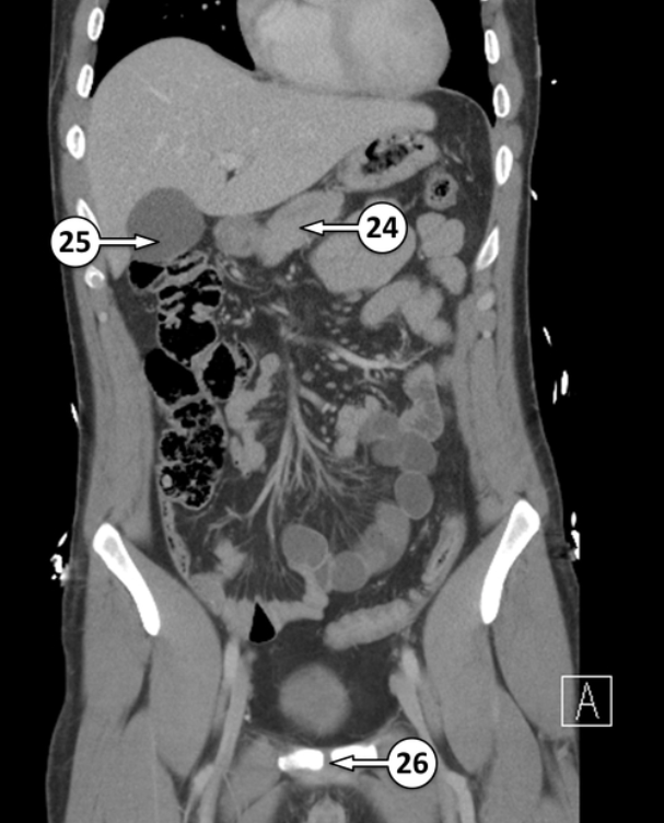 <p>24 is a part of the pancreas. Please label the specific part and the epithelium associated </p>