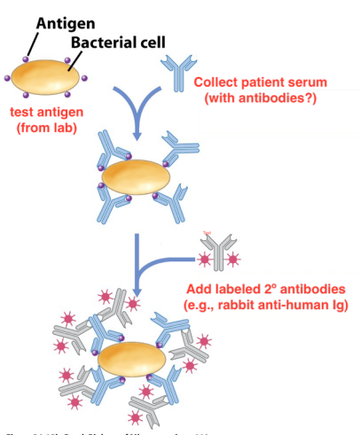 <p>Immunological Methods of Detection</p><p>Useful in detecting past exposure</p><p>This method tests for antibodies in patient serum (past exposure)</p><ul><li><p>serum from patient is collected </p></li><li><p>serum is mixed with test antigen </p><ul><li><p>if antibodies present, will bind cells </p></li><li><p>if not, serum is washed away </p></li></ul></li><li><p>secondary antibody with fluorophore added to cells </p><ul><li><p>2º ab must be from other species </p></li><li><p>2º ab binds to any ab from 1st species in Fc region </p></li><li><p>e.g., 2º ab = rabbit anti-human IgG </p></li></ul></li><li><p>can be examined by light microscopy</p></li><li><p>Use of 2º ab saves time & trouble adding fluorophore to serum antibodies; labeled 2º ab binds to many different serum ab</p></li></ul><p></p>