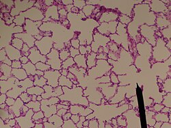 <p>What kind of structures are these?</p>
