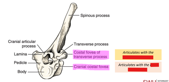 <p>Q: In the thoracic vertebrae, the costal fovea of the transverse process articulates with the …… </p><p>A. tubercle of the rib </p><p>B. head of the rib </p><p>C. costal cartilage </p><p>D. sternebrae</p>