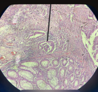 <p>tb?bệnh?</p>