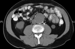 <p>identify the pathology</p>
