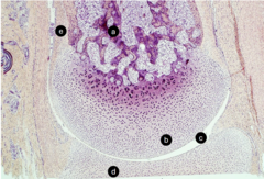 <p>e: tissue type</p>